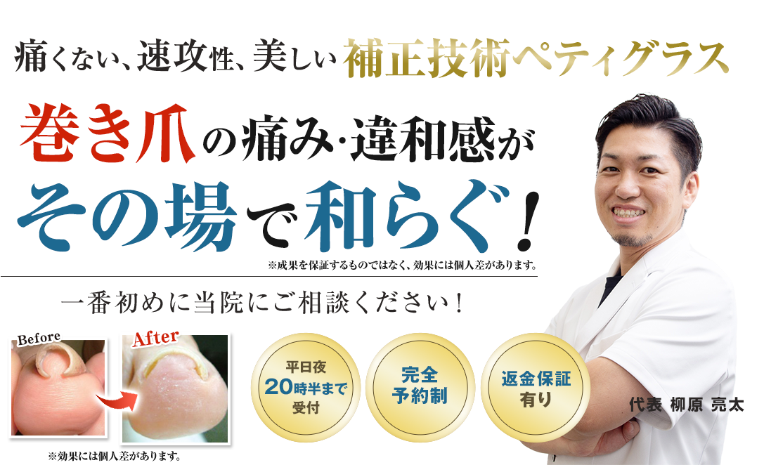 巻き爪の痛み・違和感がその場で和らぐ!