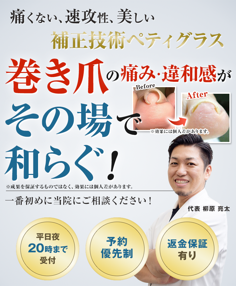 巻き爪の痛み・違和感がその場で和らぐ！